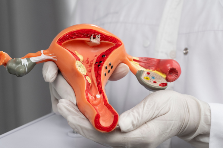 Colposcopy & Pap Smears
